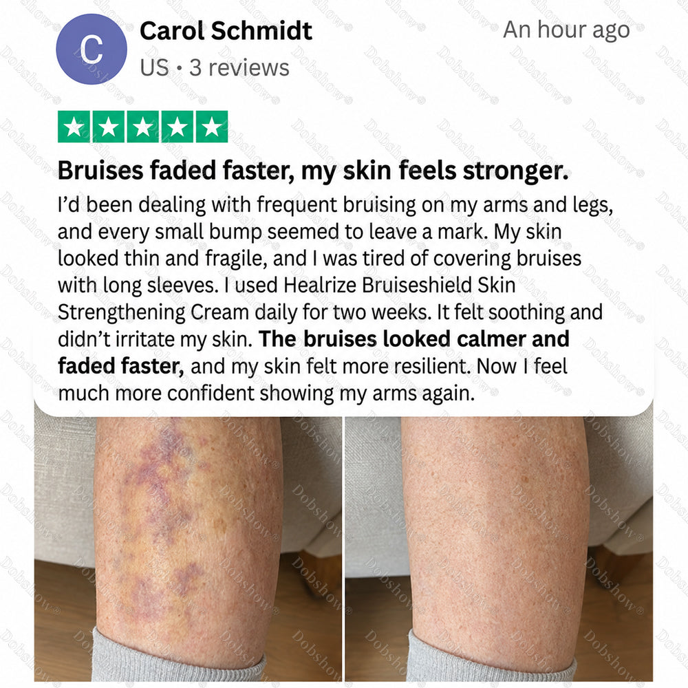 Dobshow® BRUISESHIELD Skin Strengthening Cream✨