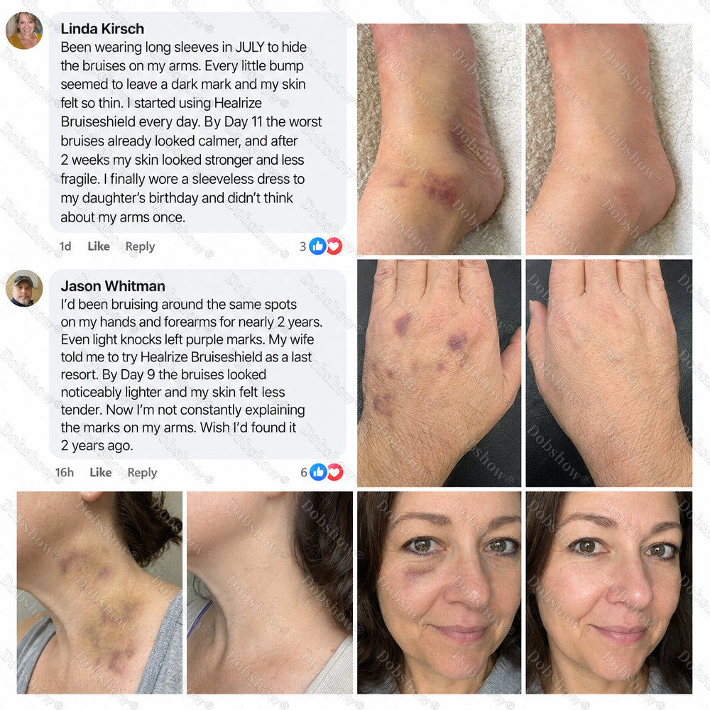Dobshow® BRUISESHIELD Skin Strengthening Cream